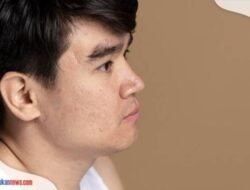 11 Cara Menghilangkan Bekas Jerawat dari Bahan Alami, Bekas Jerawat Menghitam Minggir Dulu!