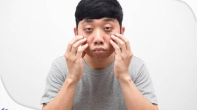cara menghilangkan mata panda