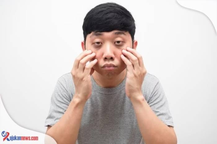 cara menghilangkan mata panda