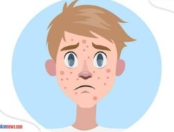 6 Cara Menghilangkan Jerawat Dalam 5 Menit yang Paling Ampuh, Bisa Mengoleskan Gel Lidah Buaya!