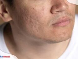 8 Cara Mengecilkan Pori Pori di Wajah yang Alami, Wajah Semakin Berseri dan Sehat!